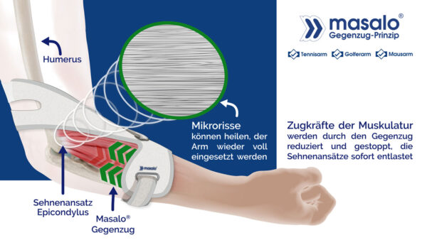 Masalo Manschette MED – Bild 3
