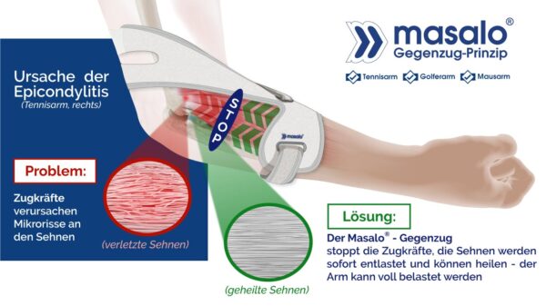 Masalo Manschette MED – Bild 5