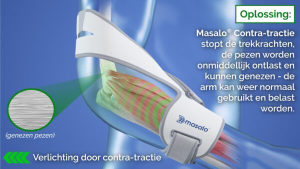 Masalo manchet MED - Afbeelding 6