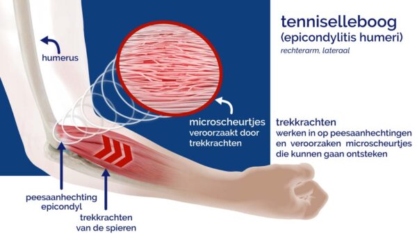 Masalo manchet MED - Afbeelding 2