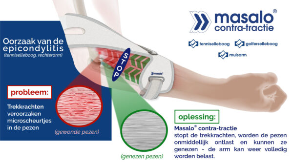 Masalo manchet MED - Afbeelding 5