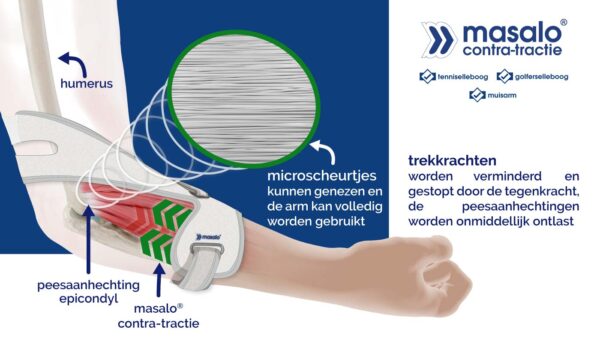 Masalo manchet MED - Afbeelding 3