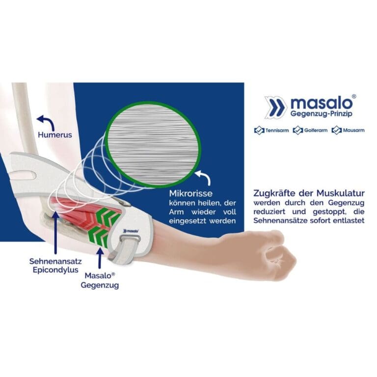 Masalo cuff: effectieve hulp voor tenniselleboog en golferselleboog